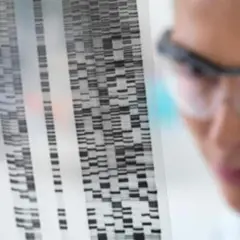 Ricercatrice analizza sequenza genetica, studiando come la schizofrenia è ereditaria.