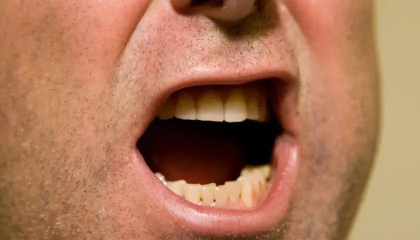 Bocca spalancata, denti visibili, sensazione di bocca secca ansia.