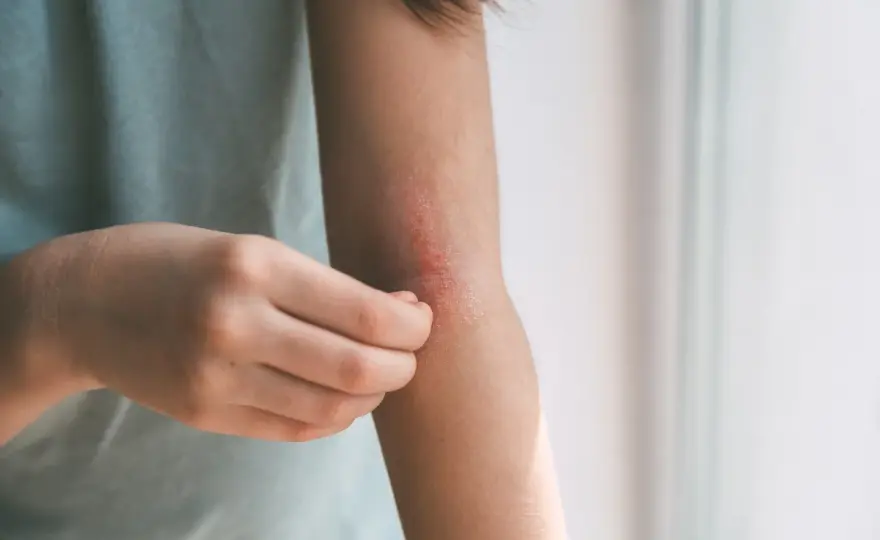 Febbre da stress? Come riconoscerla e quando preoccuparsi