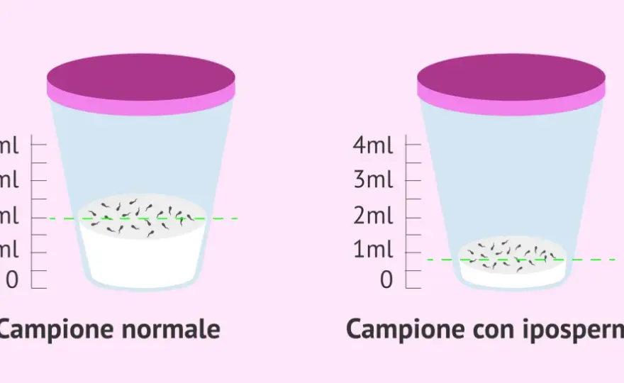 Quando un uomo non viene - Cause, soluzioni e cosa fare