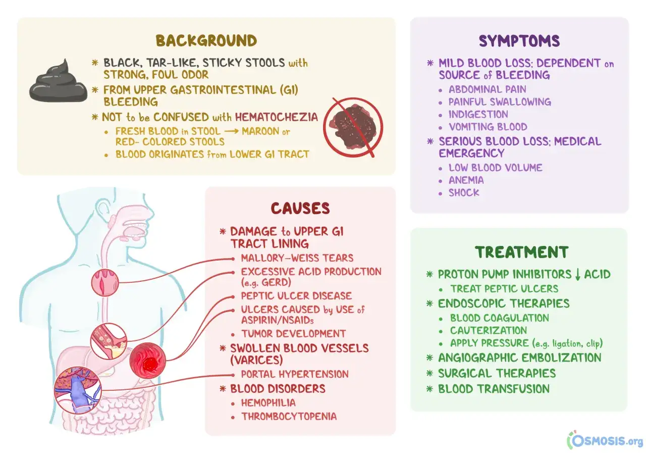 Feci nere, catramose, con odore forte, indicano sanguinamento gastrointestinale superiore. L'ansia può peggiorare i sintomi.